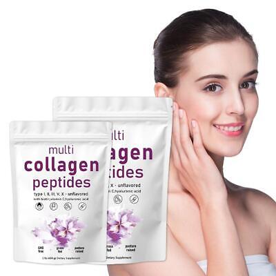 COLLAGEN PEPTIDES